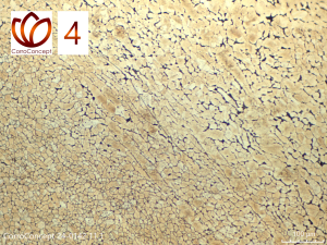 Mikroskopische Aufnahme eines metallografischen Schliffs einer ungünstig wärmebehandelten Messing-Probe